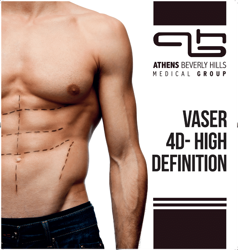 vaser 4d high definition