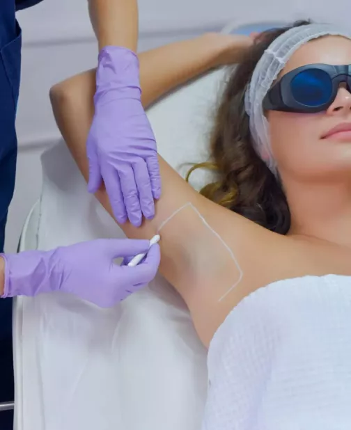 Woman lying down as a doctor marks lines on her armpit for laser hair removal